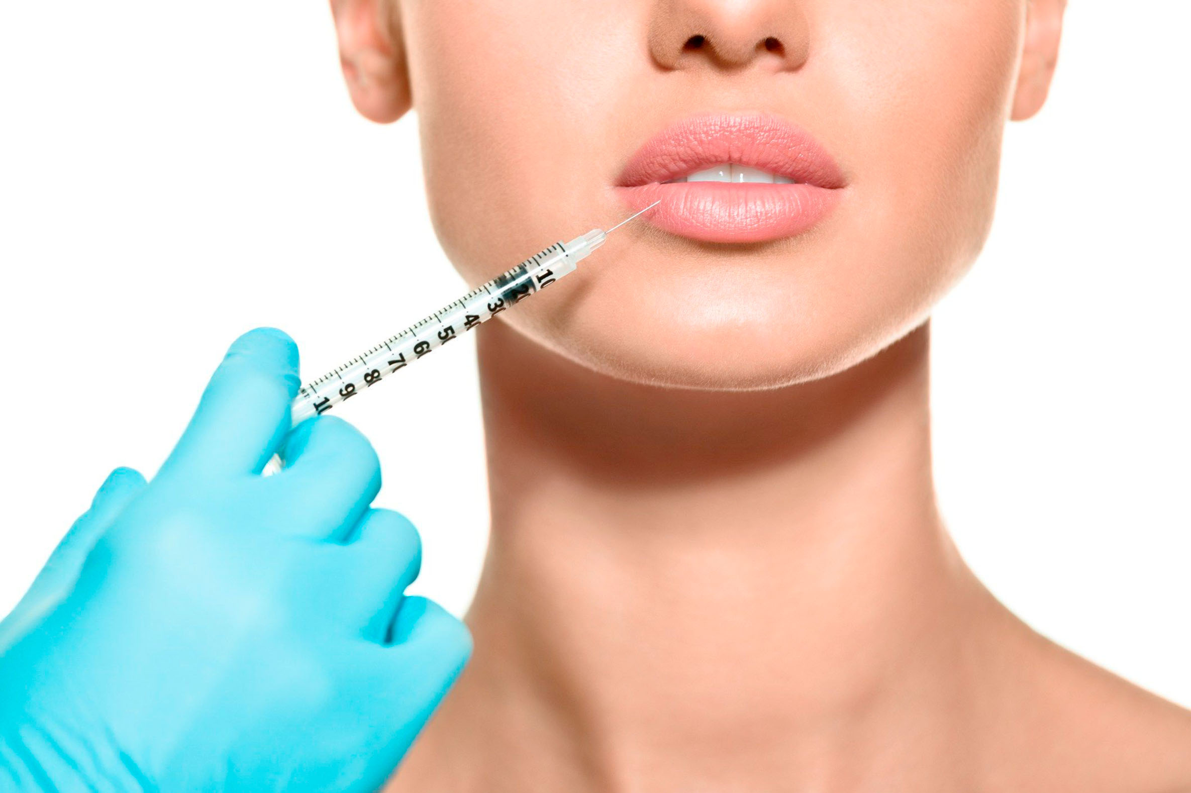 Увеличение и коррекция губ гиалуроновой кислотой 