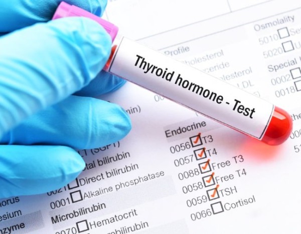 Анализ на гормоны щитовидной железы