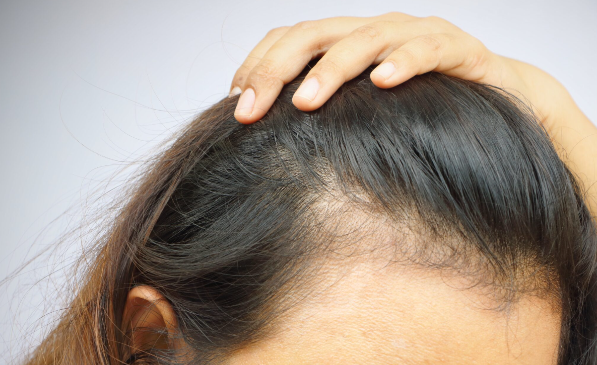 Средство от выпадения волос после болезни - ООО «Медицина»